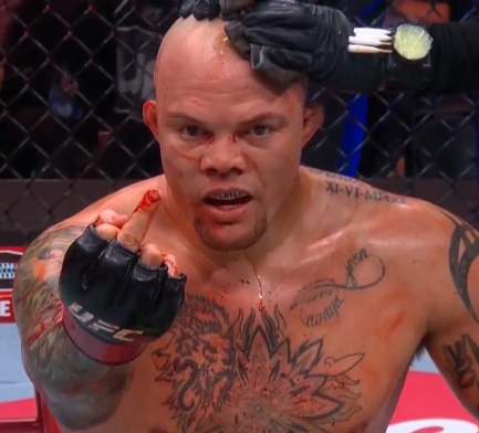 Anthony Smith (Old Photo)