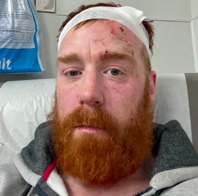 Sheamus Suffers Head Injury Photo